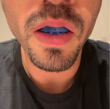 Zquiet Anti Snoring Mouthpiece image